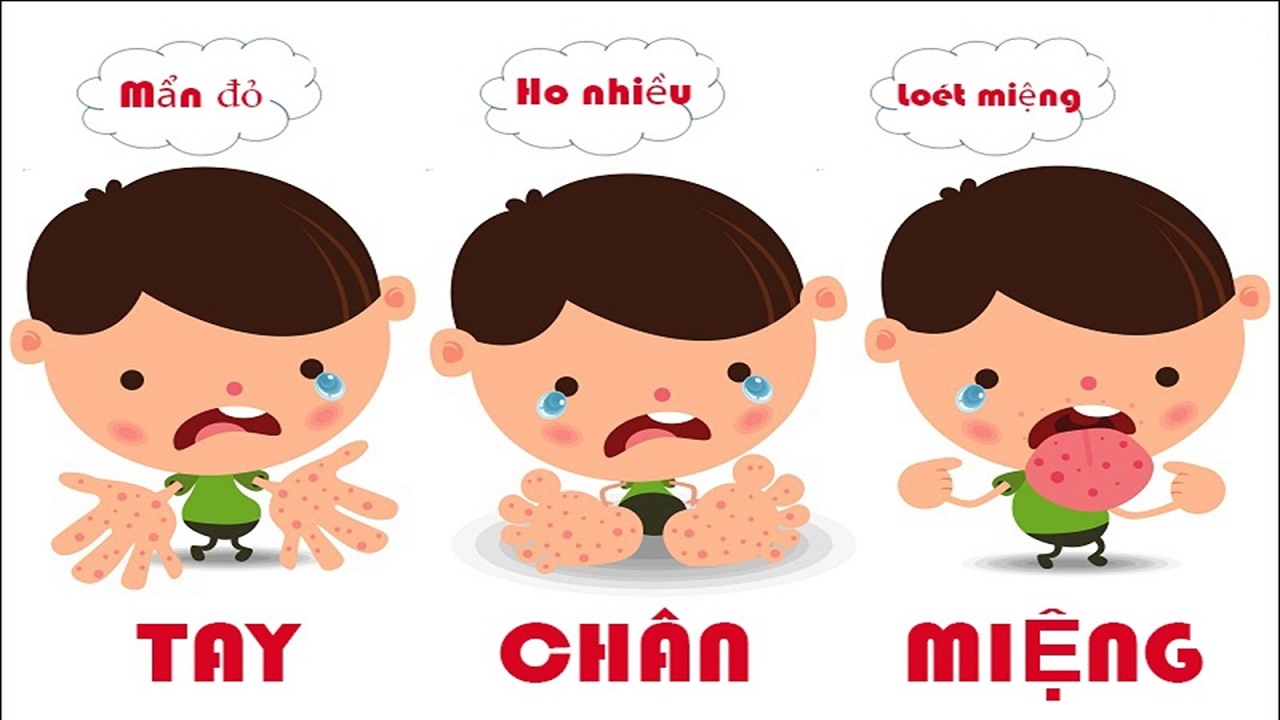 Bệnh tay chân miệng - Hiểu rõ để bảo vệ con