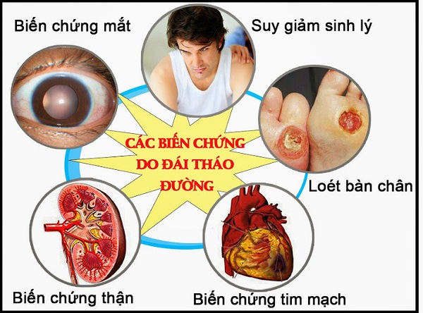 Bệnh tiểu đường - Những thông tin cần biết