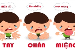Bệnh tay chân miệng - Hiểu rõ để bảo vệ con