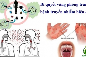 Bí quyết vàng phòng tránh bệnh truyền nhiễm hiệu quả