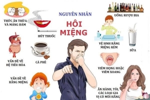 Cách chữa hôi miệng dứt điểm ngay tại nhà