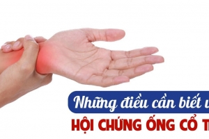 Hội chứng ống cổ tay - Hiểu rõ để phòng ngừa và điều trị